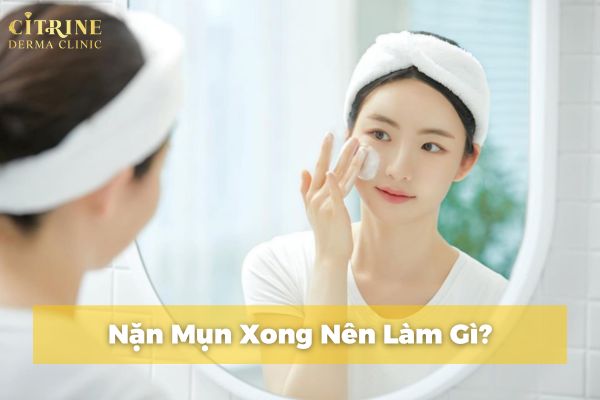 Nặn mụn xong nên làm gì