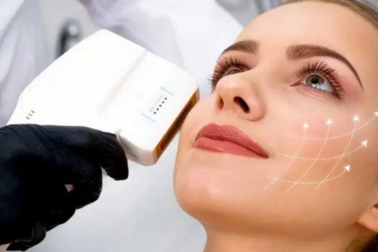 Nâng cơ mặt HIFU giúp cải thiện độ săn chắc và đường nét khuôn mặt