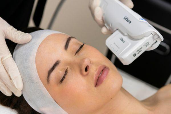 Nâng cơ HIFU tác động sâu giúp cải thiện chảy xệ và trẻ hóa da