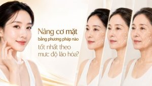Nâng cơ mặt bằng phương pháp nào tốt nhất