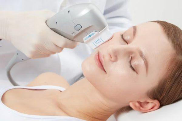 Nâng cơ mặt HIFU được thực hiện theo quy trình thăm khám và điều trị chuẩn