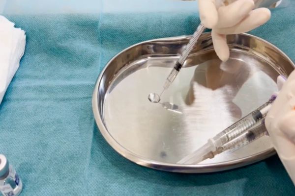 Biến chứng filler mũi chủ yếu do sai kỹ thuật và sản phẩm kém chất lượng