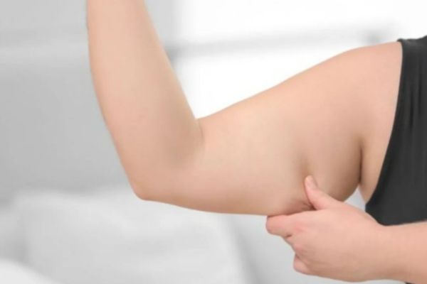 Bắp tay to có thể do cơ phát triển, tích mỡ hoặc yếu tố di truyền