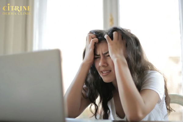 Rối loạn nội tiết và căng thẳng kéo dài dễ gây mụn ở cằm
