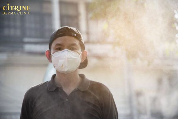Đeo khẩu trang lâu gây bí da và dễ làm mụn ở cằm nặng hơn
