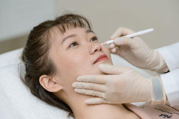 Tiêm BAP Profhilo giúp trẻ hóa tự nhiên ít đau và không cần nghỉ dưỡng