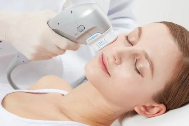 Nâng cơ mặt HIFU được thực hiện theo quy trình thăm khám và điều trị chuẩn