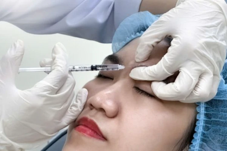 Quy trình botox xóa nhăn chuẩn y khoa, an toàn và chính xác