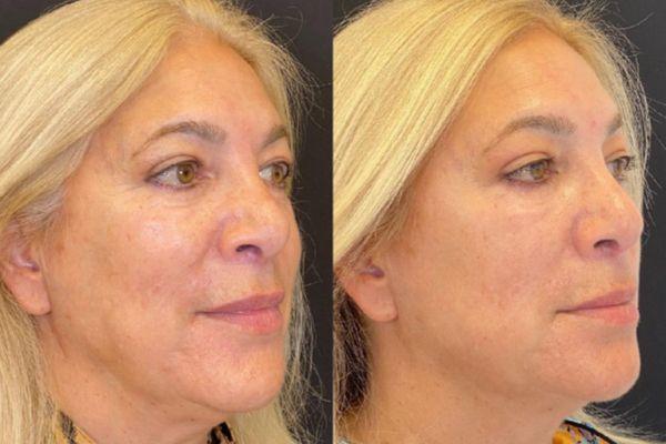 Các bước điều trị chuẩn y khoa tại Citrine Clinic