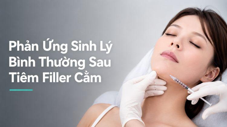Cằm hơi đỏ nhẹ sau tiêm filler đúng cách