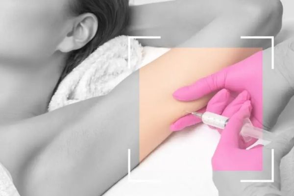 Tiêm botox bắp tay