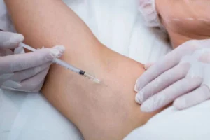 tiêm botox giảm mồ hôi nách