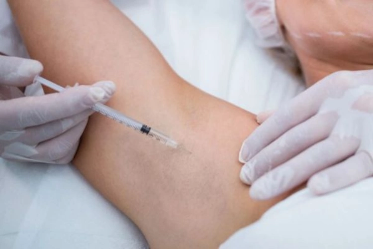 tiêm botox giảm mồ hôi nách