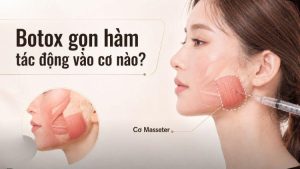 Minh họa vị trí cơ masseter hai bên góc hàm
