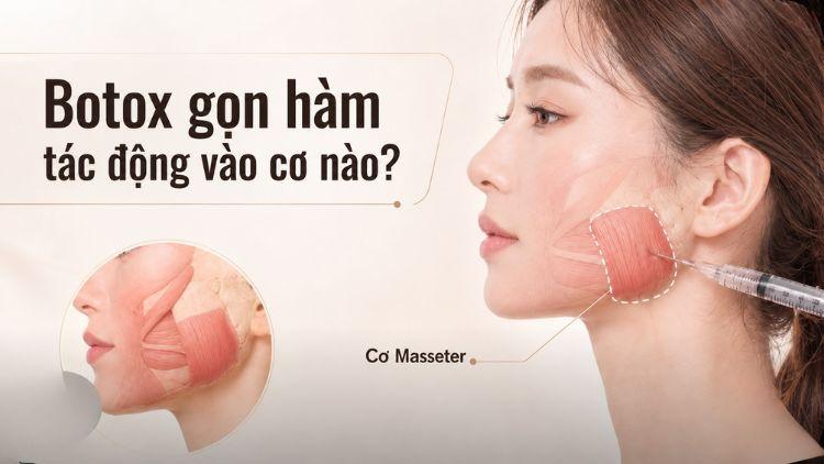 Minh họa vị trí cơ masseter hai bên góc hàm