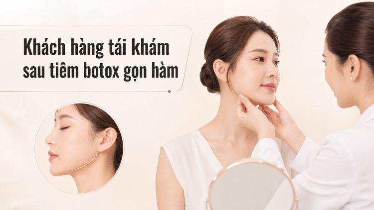 Khách hàng tái khám sau tiêm botox gọn hàm