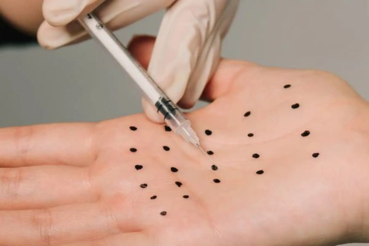 Tiêm botox mồ hôi tay được đánh giá an toàn khi thực hiện đúng kỹ thuật