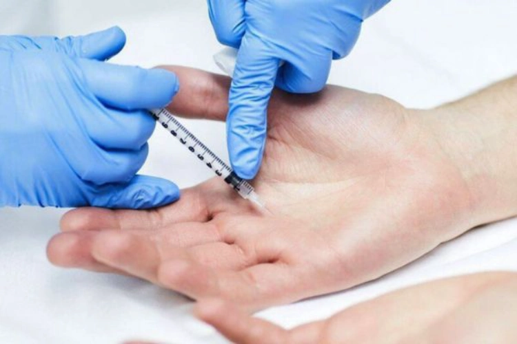 Tiêm botox mồ hôi tay là phương pháp kiểm soát tăng tiết mồ hôi
