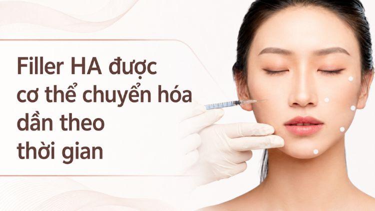 Filler HA được cơ thể chuyển hóa dần theo thời gian