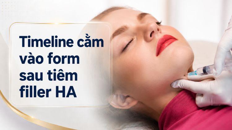 Timeline cằm vào form sau tiêm filler HA