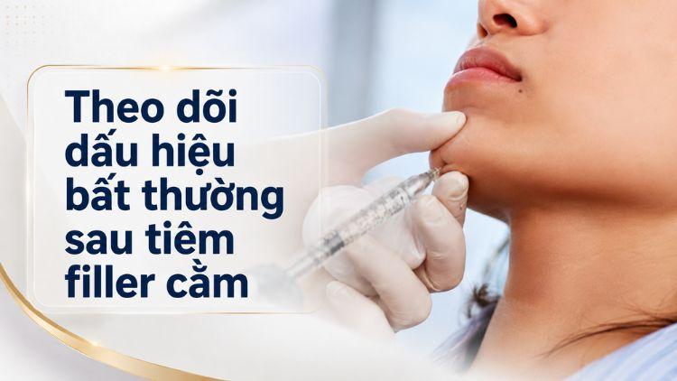 Theo dõi dấu hiệu bất thường sau tiêm filler cằm