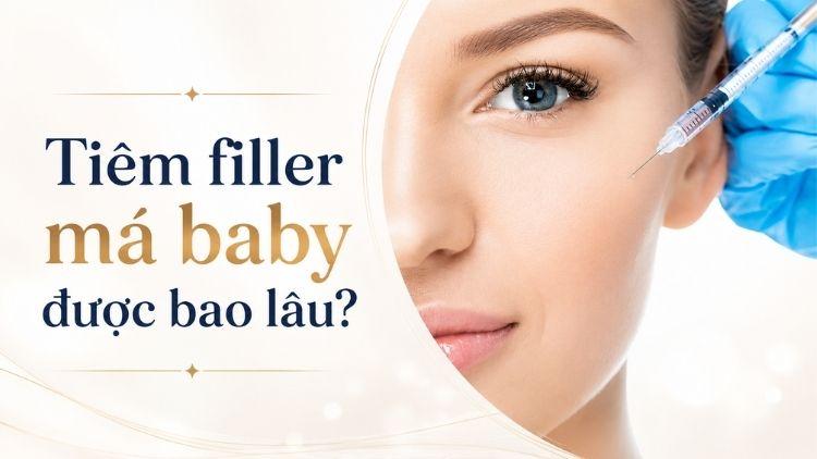 Kết quả filler má baby duy trì tùy cơ địa mỗi người