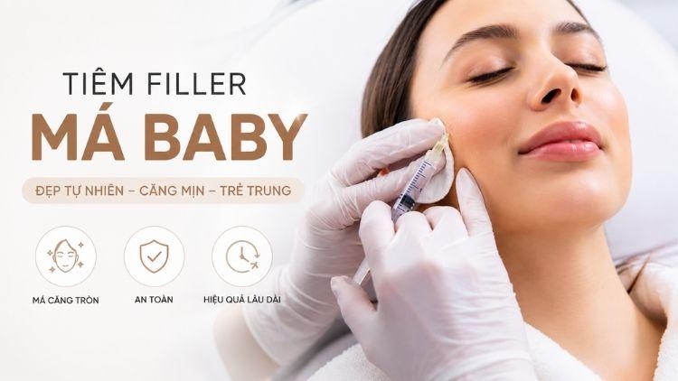 Tiêm Filler Má Baby: Quy Trình, Thời Gian Duy Trì & Lưu Ý