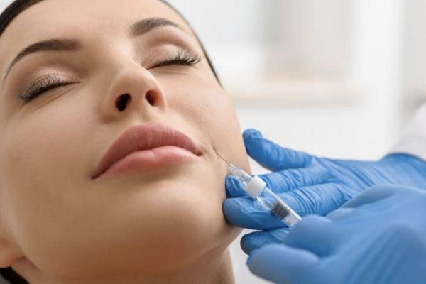 Tiêm Filler Rãnh Cười Bao Lâu Thì Mềm Và Mẹo Để Đẹp Tự Nhiên