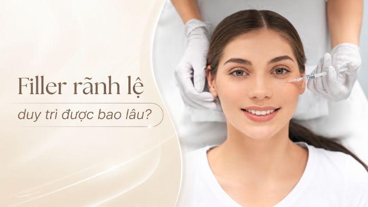Hiệu quả filler rãnh lệ duy trì tùy cơ địa