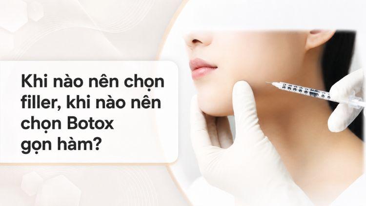 So sánh filler và Botox trong tạo hình vùng hàm dưới