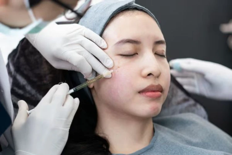 tiêm meso trị mụn