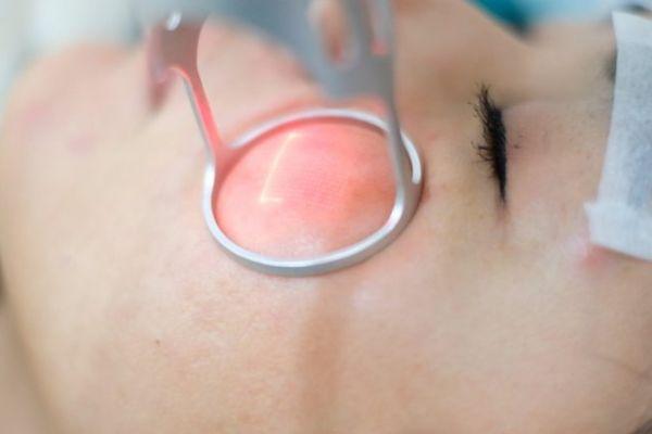 Hiệu quả laser phụ thuộc công nghệ, tay nghề và chăm sóc da