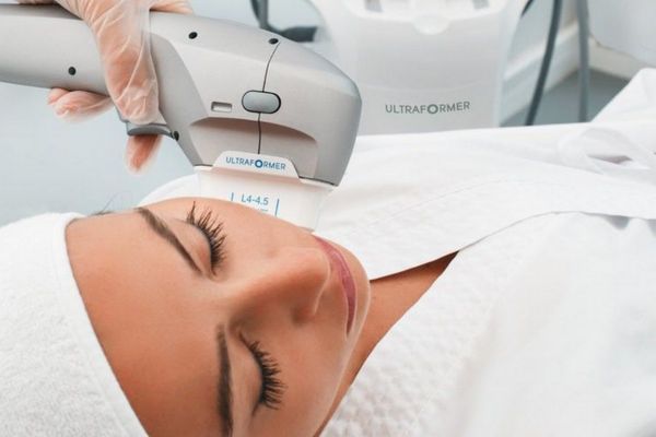 Ultherapy nâng cơ không xâm lấn, tác động tầng SMAS, trẻ hóa da hiệu quả