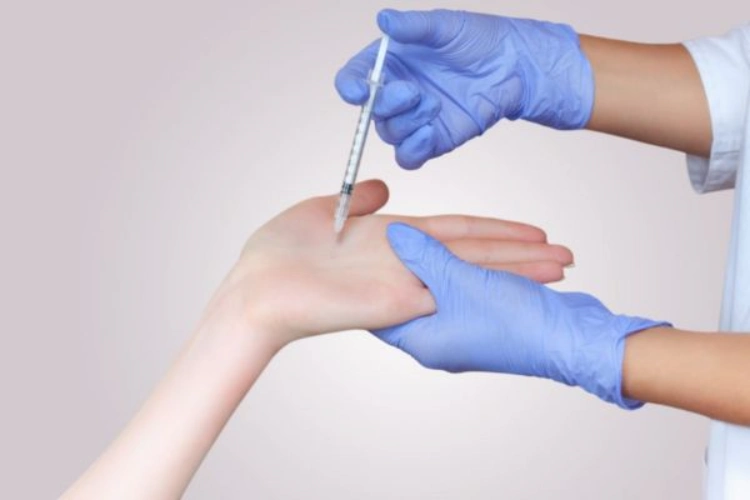 Tiêm botox giảm mồ hôi tay nhờ hiệu quả nhanh và ít xâm lấn