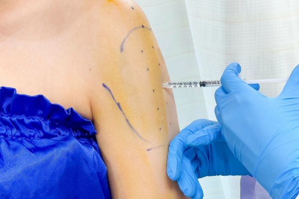 Tiêm botox bắp tay có ưu điểm nhanh gọn nhưng hiệu quả chỉ tạm thời