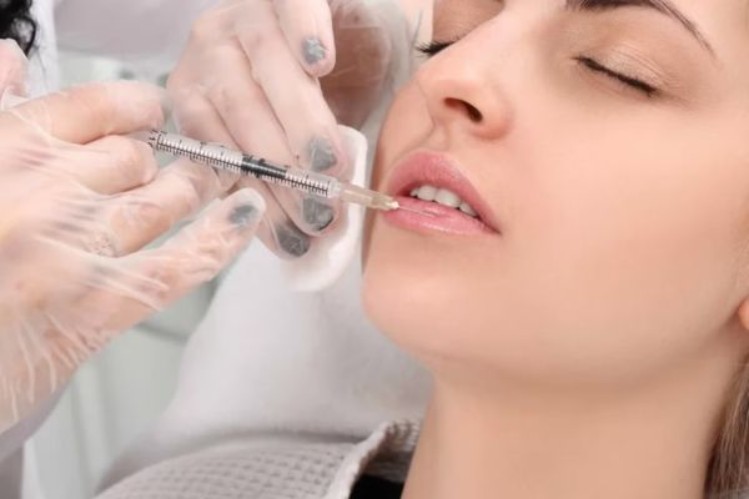 Tiêm filler có nhiều ưu điểm nhưng cũng tồn tại một số hạn chế