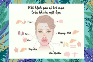 Vị trí mọc mụn