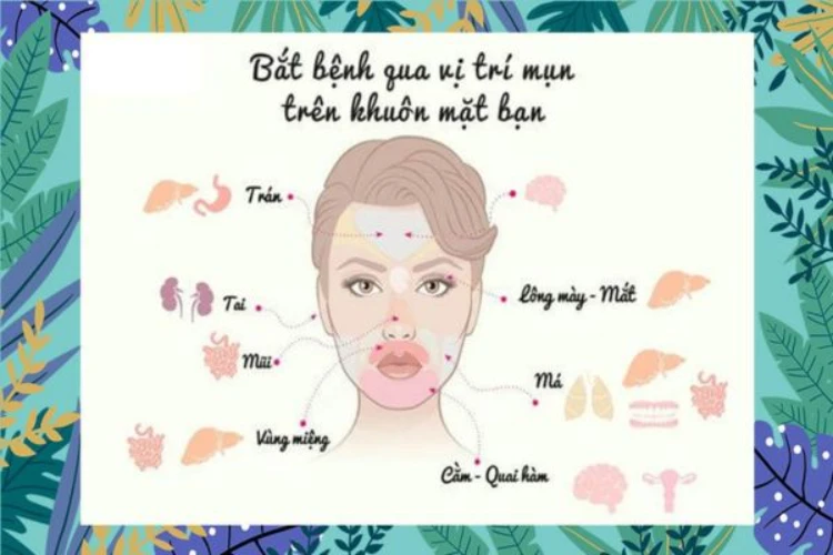 Vị trí mọc mụn