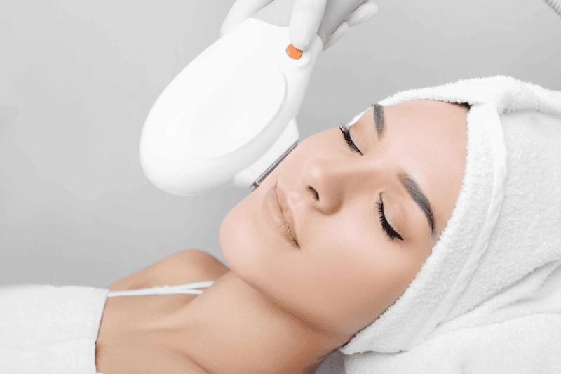 Ánh sáng từ IPL giúp làm thưa lông 