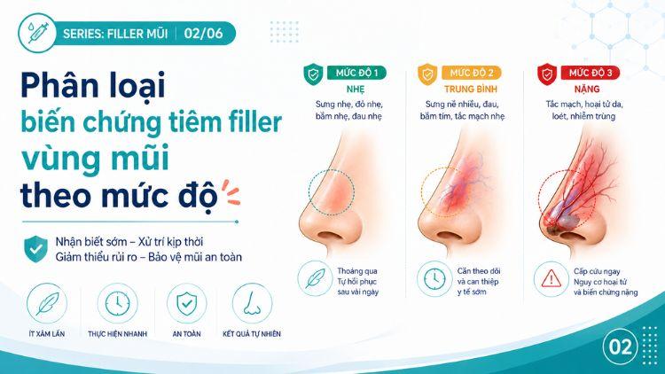 Các dấu hiệu biến chứng filler mũi theo từng giai đoạn
