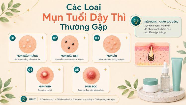Các mức độ mụn tuổi dậy thì thường gặp