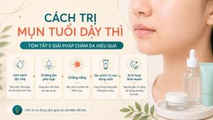 cách trị mụn tuổi dậy thì