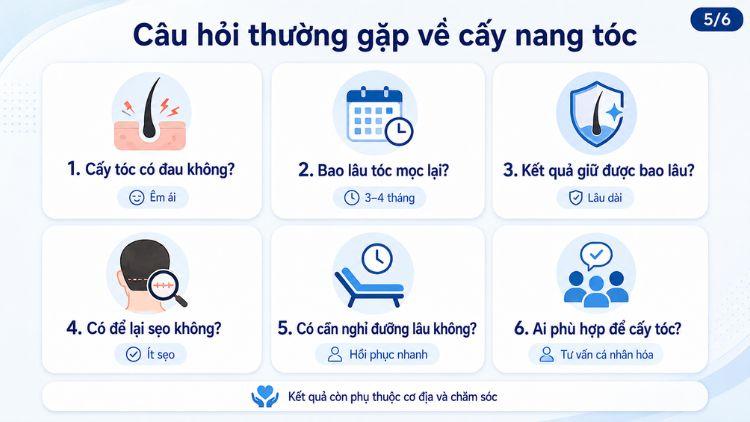 Giải đáp những thắc mắc thường gặp về cấy nang tóc