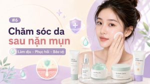 chăm sóc da sau nặn mụn