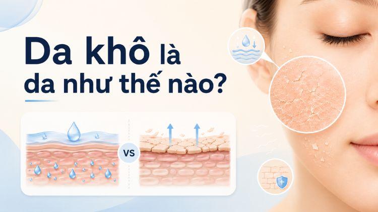 Da bị khô thường gây căng rát và bong tróc nhẹ