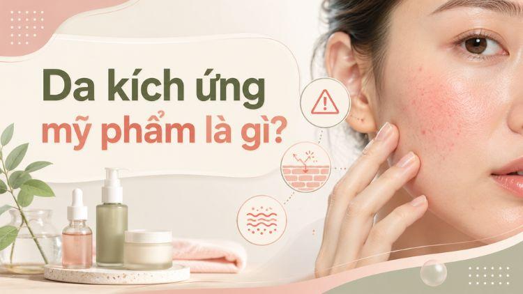 Da đỏ rát sau khi dùng mỹ phẩm không phù hợp