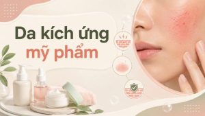 da kích ứng mỹ phẩm