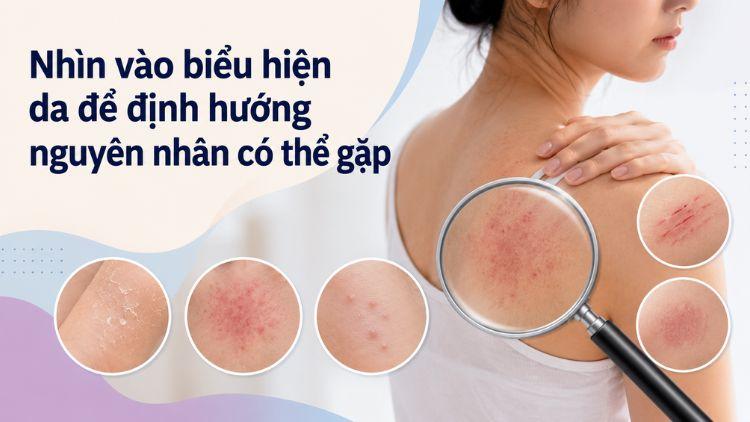 Các biểu hiện trên da giúp định hướng nguyên nhân