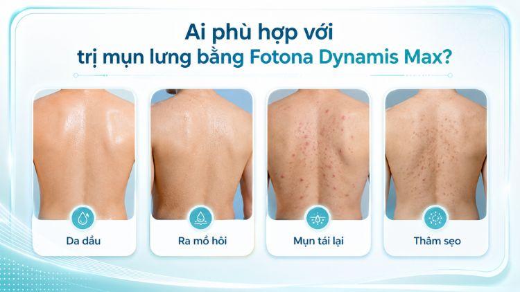 Người bị mụn lưng dai dẳng nên được đánh giá