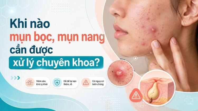 Thăm khám chuyên khoa khi mụn viêm sâu kéo dài